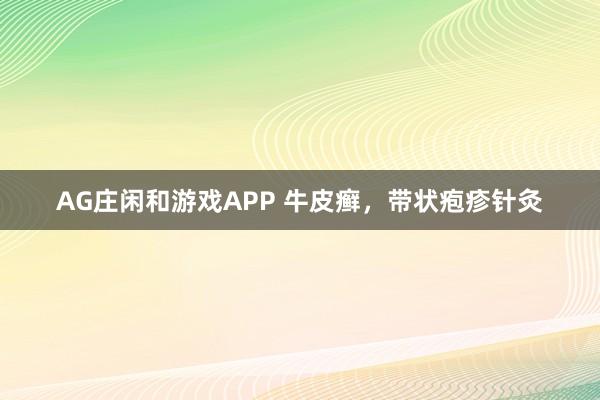 AG庄闲和游戏APP 牛皮癣，带状疱疹针灸